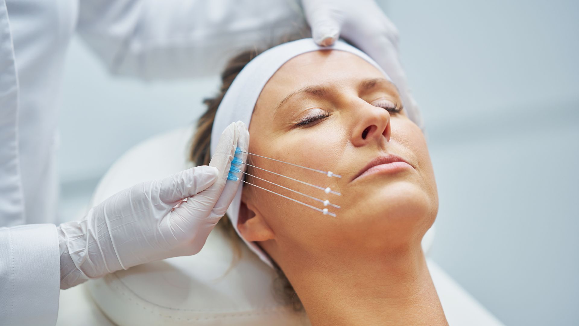 Apa Itu Treatment Tanam Benang???