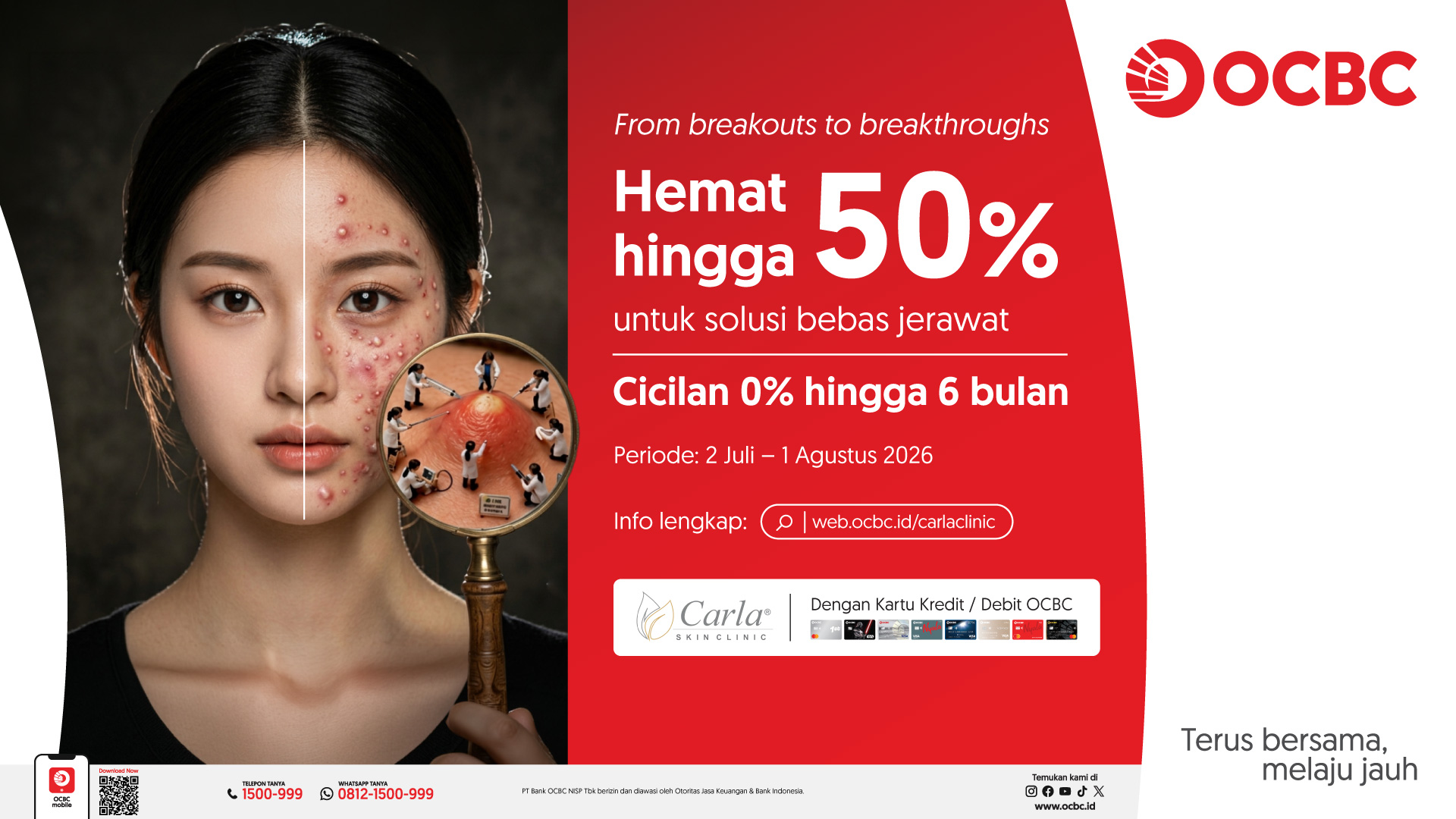 Bebas Jerawat Lebih Hemat dengan Promo OCBC x Carla Skin Clinic