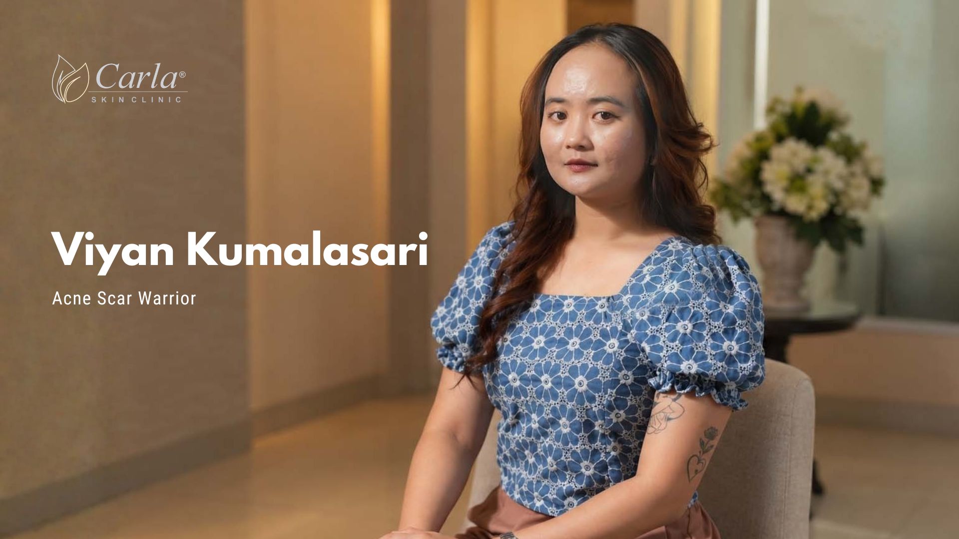 Empat Tahun Menyembunyikan Wajah, Viyan Kini Berani Tampil Tanpa Masker