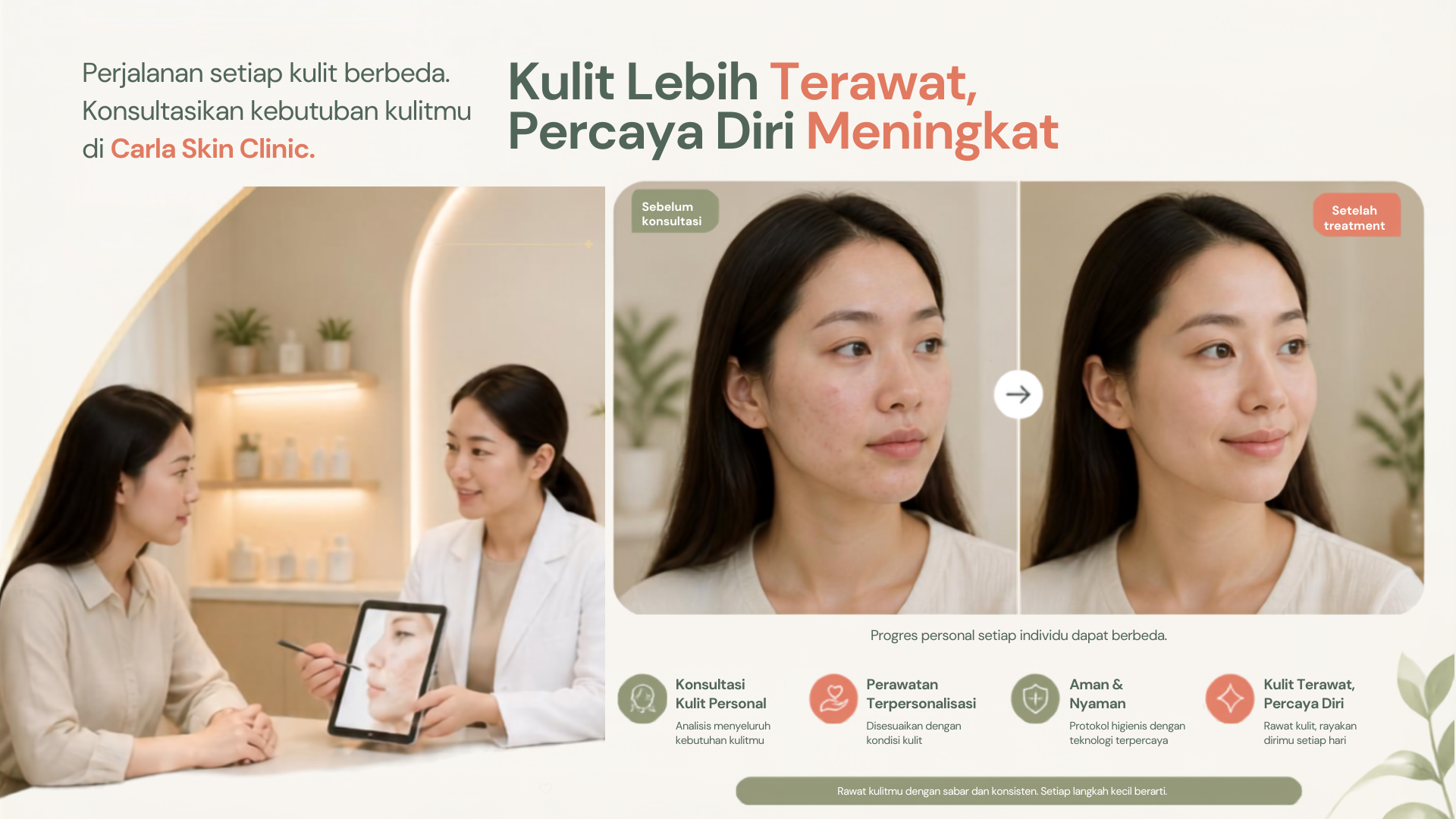 Sejuta Kisah Sembuh dari Jerawat bersama Carla Skin Clinic
